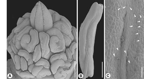 Bombax ceiba. Late stages of androecium development and androecium... | Download Scientific Diagram