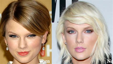 Taylor Swift Plastic Surgery Before And After Photos