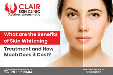 What are the Benefits of Skin Whitening Treatment and How much does it Cost