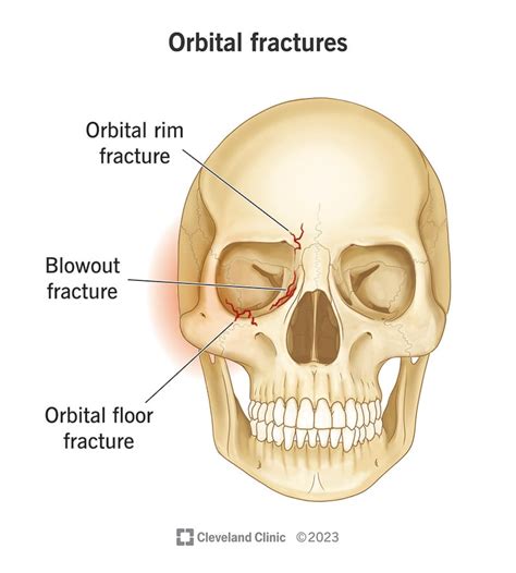 Eye Socket Bone Anatomy