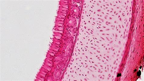 Epithelial Tissues: Pseudostratified Columnar Epithelium | Flickr