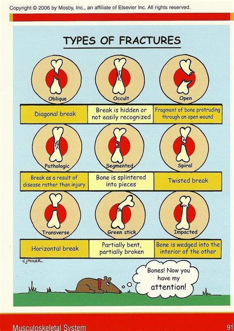 Describe the Different Types of Fractures