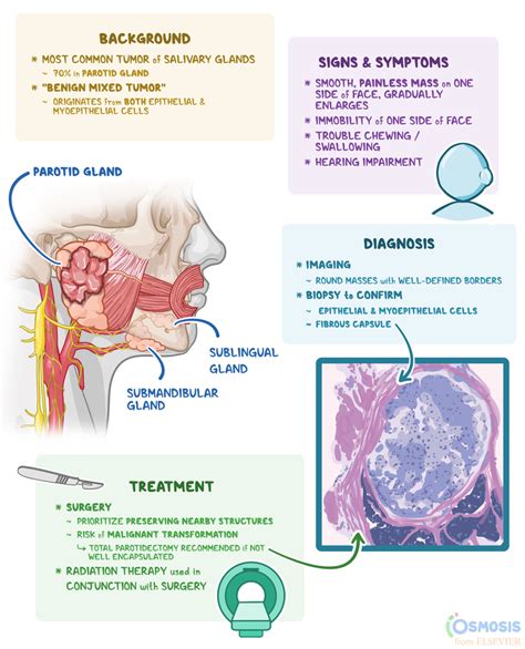 Pleomorphic Adenoma Parotid