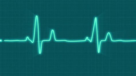 Looped Animated Ecg Electrocardiogram Display. Stock Footage Video (100 ...