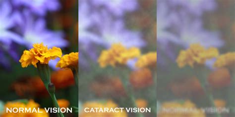 image processing - Simulate cataract vision in OpenCV - Stack Overflow