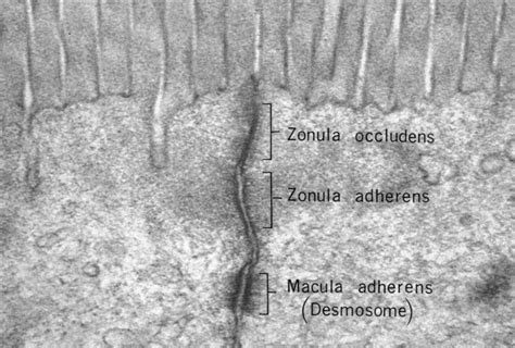 Electron Micrograph