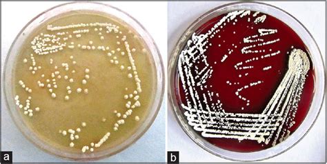 Blood Agar vs Nutrient Agar- Know Your Agar Plates - Advancells Group