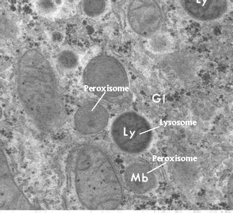 Lysosome Electron Micrograph