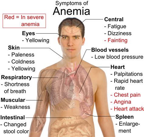 Types of Anemia | Medical Laboratories