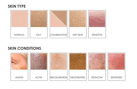 SKIN TYPES & CONDITIONS – leaderma