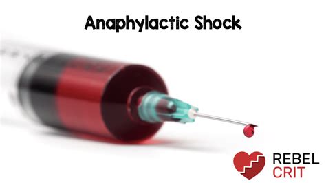 Anaphylactic Shock - REBEL EM - Emergency Medicine Blog