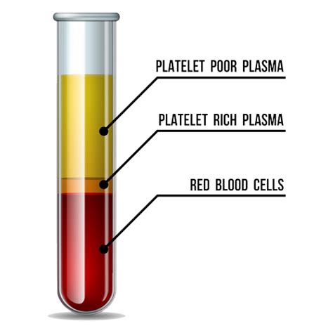 Platelet-rich Plasma Therapy | Spartanburg Regional