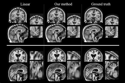 How To Get A Brain Scan - The mri scan at your scanning centre chosen ...