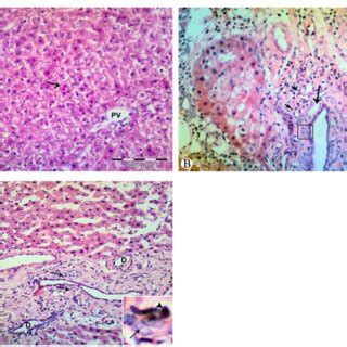 Photomicrograph of liver tissue in the control (d), liver injury (e),... | Download Scientific ...