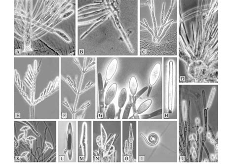 Examples of morphologies present in the four ASR analyses. A: Simple... | Download Scientific ...