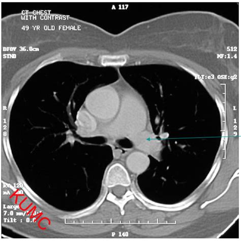 CT SCAN CHEST 5 Diagram | Quizlet