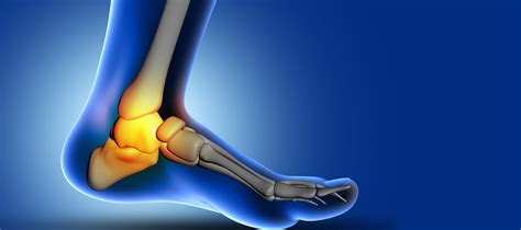 Soft Tissue Injuries: Find the Types & Treatment Online | Meril Life