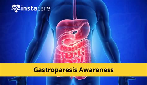 Gastroparesis: Symptoms, Causes, Complications and Diagnosis