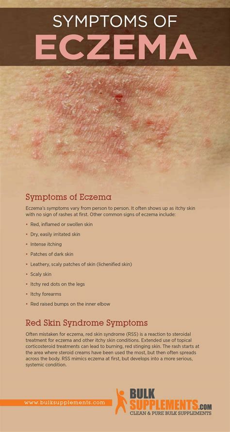 How To Relieve Eczema Itching - Headassistance3