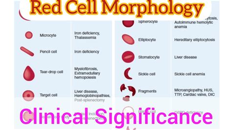 RBC Abnormal Morphology | Size shape & hemoglobin Content of RBC| Clinical Significance ...