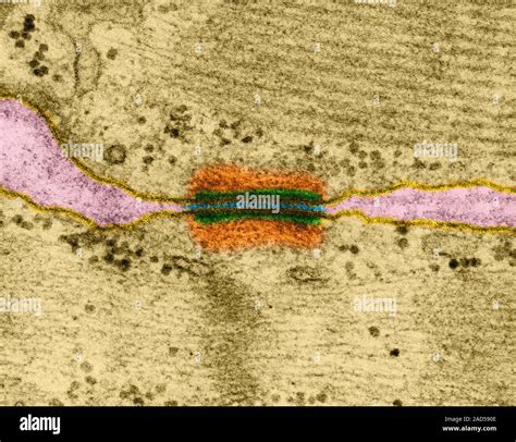 Desmosome (also known as macula adherens) between heart muscle cells, coloured transmission ...