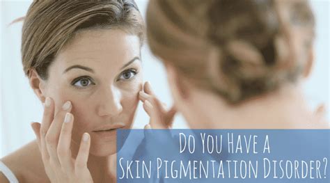 Do You Have a Skin Pigmentation Disorder? | Lee's Summit & Kansas City