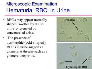 Urinalysis | PPT