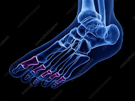 Middle phalanx bone, illustration - Stock Image - F027/5935 - Science Photo Library