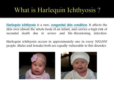 Harlequin Ichthyosis: Causes, symptoms, complications and treatment.