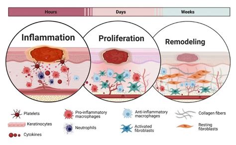 Stages Of Wound Healing Overview, Process Timeline Video, 45% OFF