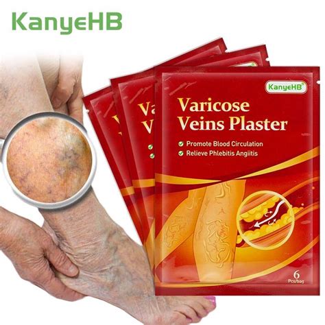 VARICOSE VEINS PLASTER patch penghilang urat timbul urat bengkak urat angin spider veins ...