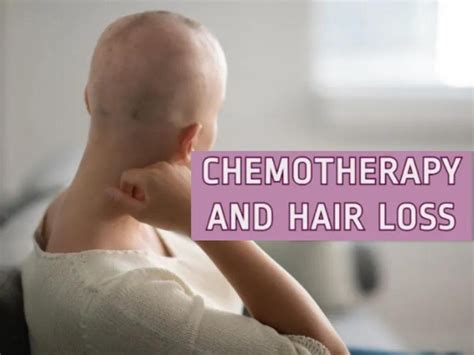 Understanding and Managing Chemotherapy-Related Hair Loss