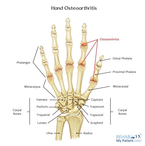 Diagram Of The Hand Joints