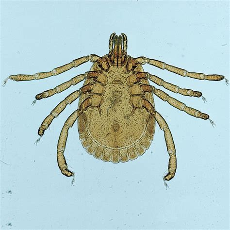 Mite, w.m. Microscope Slide | Carolina.com