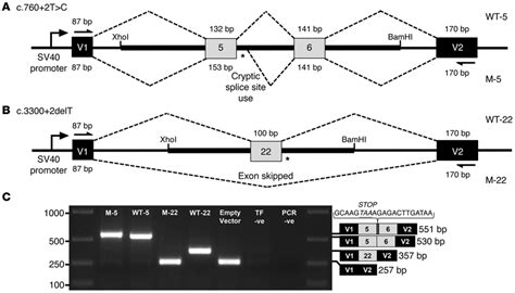 Splice donor site mutations lead to cryptic splice site use or exon... | Download Scientific Diagram