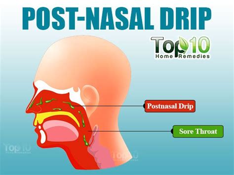 Home Remedies for Post-Nasal Drip | Top 10 Home Remedies