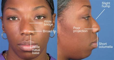 Nose Types - Personality, Ethnicity and Ancestry