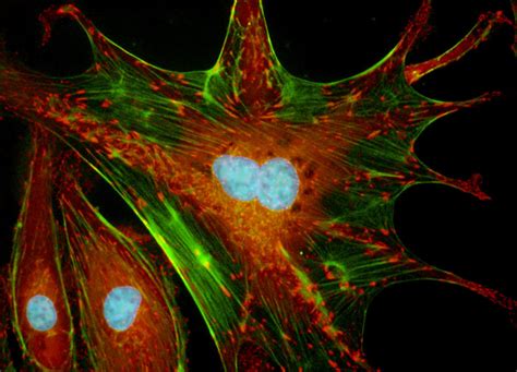 Bovine Pulmonary Artery Endothelial Cells with DAPI, Cy3, and Alexa ...