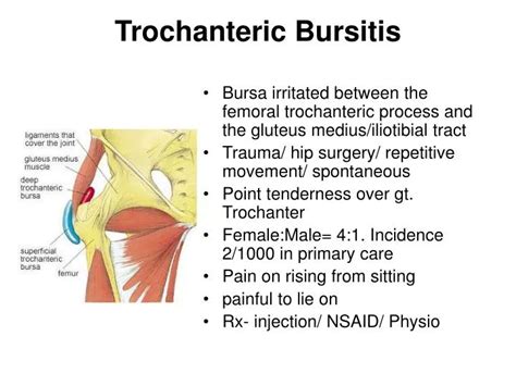 Severe Symptoms Of Hip Bursitis