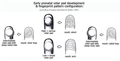 10 Facts about Radial Loop Fingerprints! | Radial loops, ulnar loops