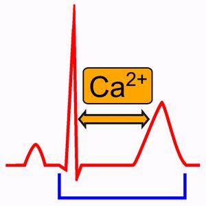 Hypocalcemia Ekg