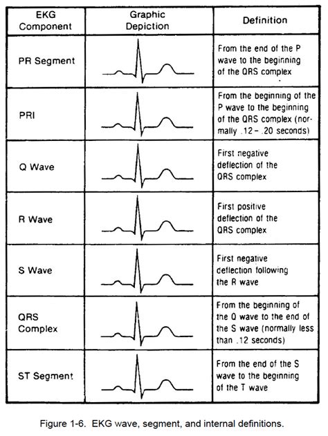 1-05. GRAPHIC DISPLAY OF ELECTROCARDIOGRAM (D) - Cardiac Rhythm ...