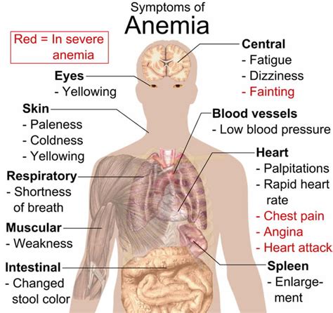 Anemia Could Affect Recovery From TBI - Neuroscience News