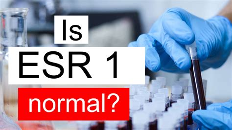 Is ESR 1 normal, high or low? What does ESR level 1 mean?