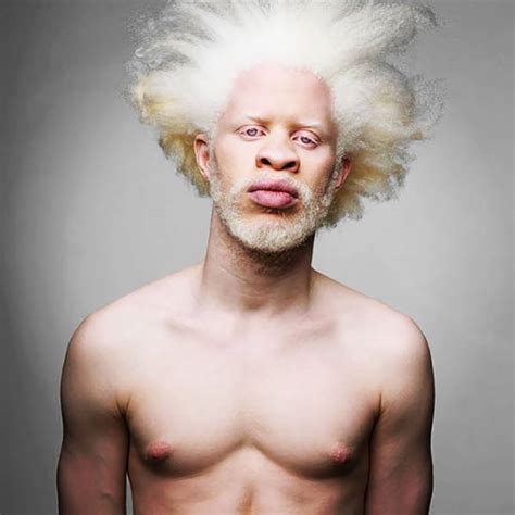 These Beautiful Albino People Are Simply Breathtaking (58 pics) - Izismile.com