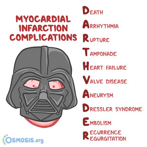 Complications of myocardial... - Osmosis from Elsevier