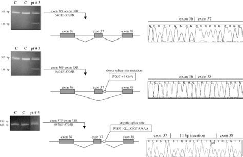 Splice-site mutation at position +5 of the donor splice site of laminin... | Download Scientific ...