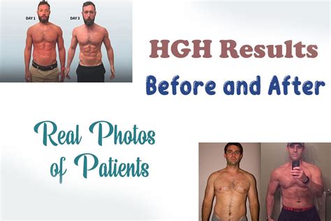 See HGH Results Before and After Replacement Therapy - HRTUS