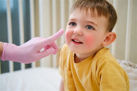 Masters of Pediatric Dermatology Course Offered to Healthcare Providers