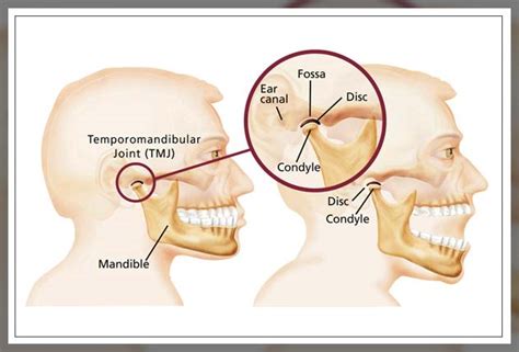 Ways to Cope with Misaligned Jaw Pain - Dentist Ahmed